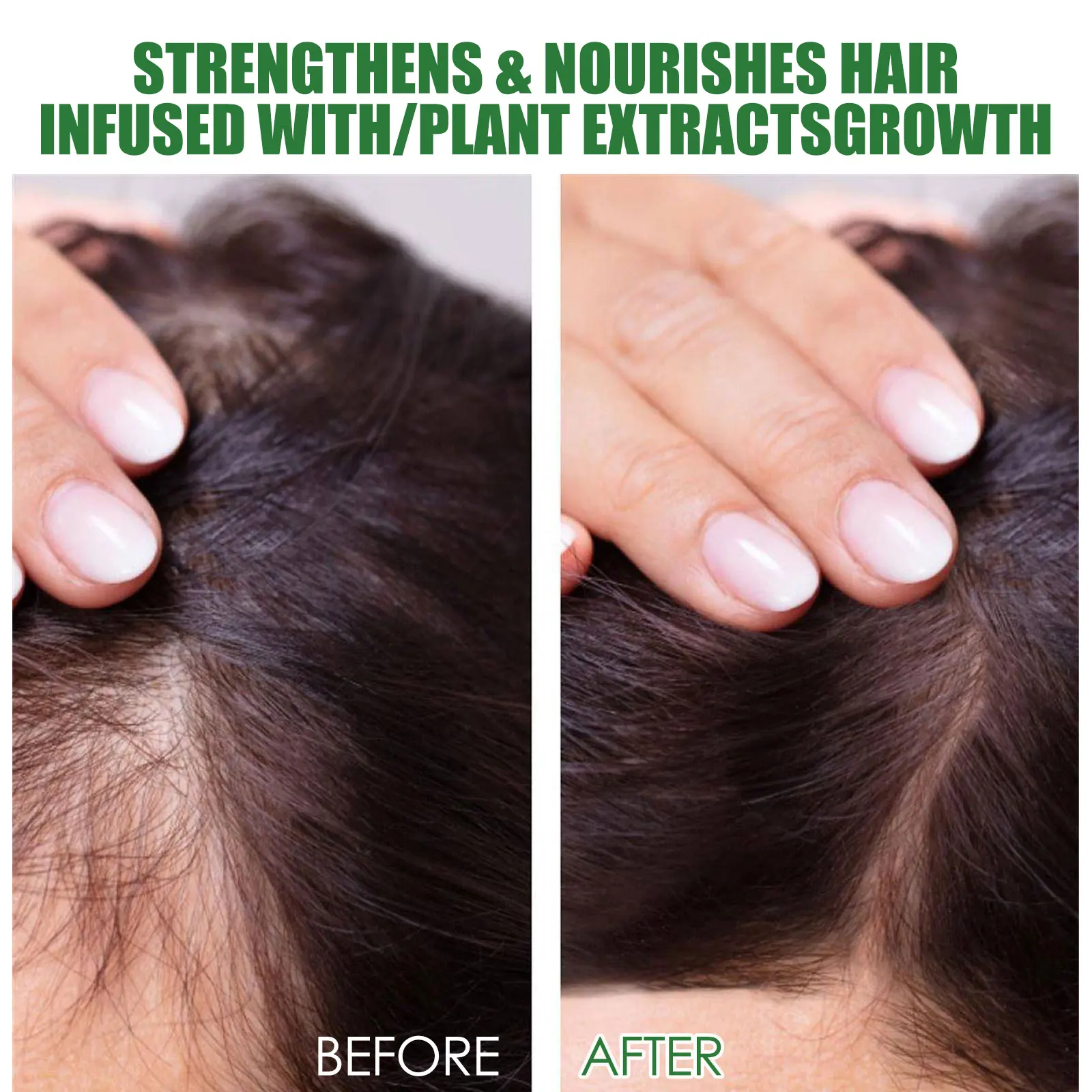 Rosemary Hair Care Set Contains Rosemary Hair Roller Hair Spray Essential Oil Nourish Hair Soft Fluffy Strong Moisturizing Root - Image 5