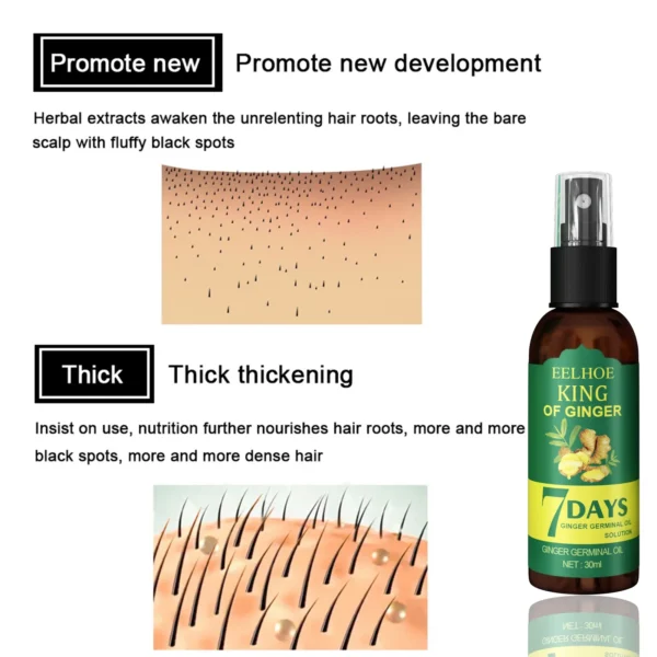 Antiloss Ginger Hair Growth Essential Oil Hair Regrowth Serum Fast Growth Prevent Baldness Treatment Alopecia Hair Care Product - Image 4