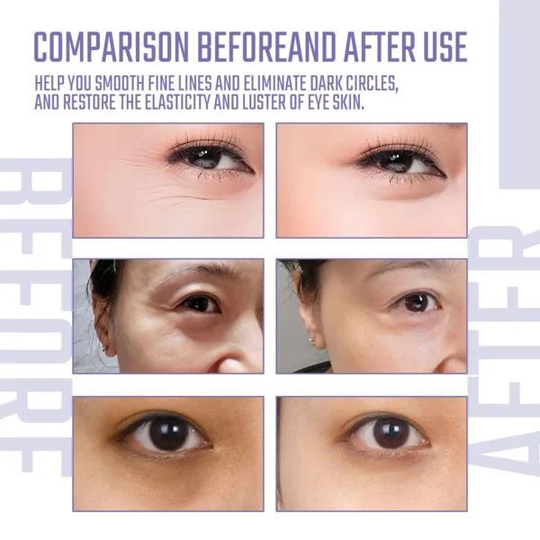 Collagen Eye Mask To Reduce Dark Circles and Eye Bags, Moisturizing, Hyaluronic Acid Nourishing Eye Patch Eye Skin Care Products - Image 2